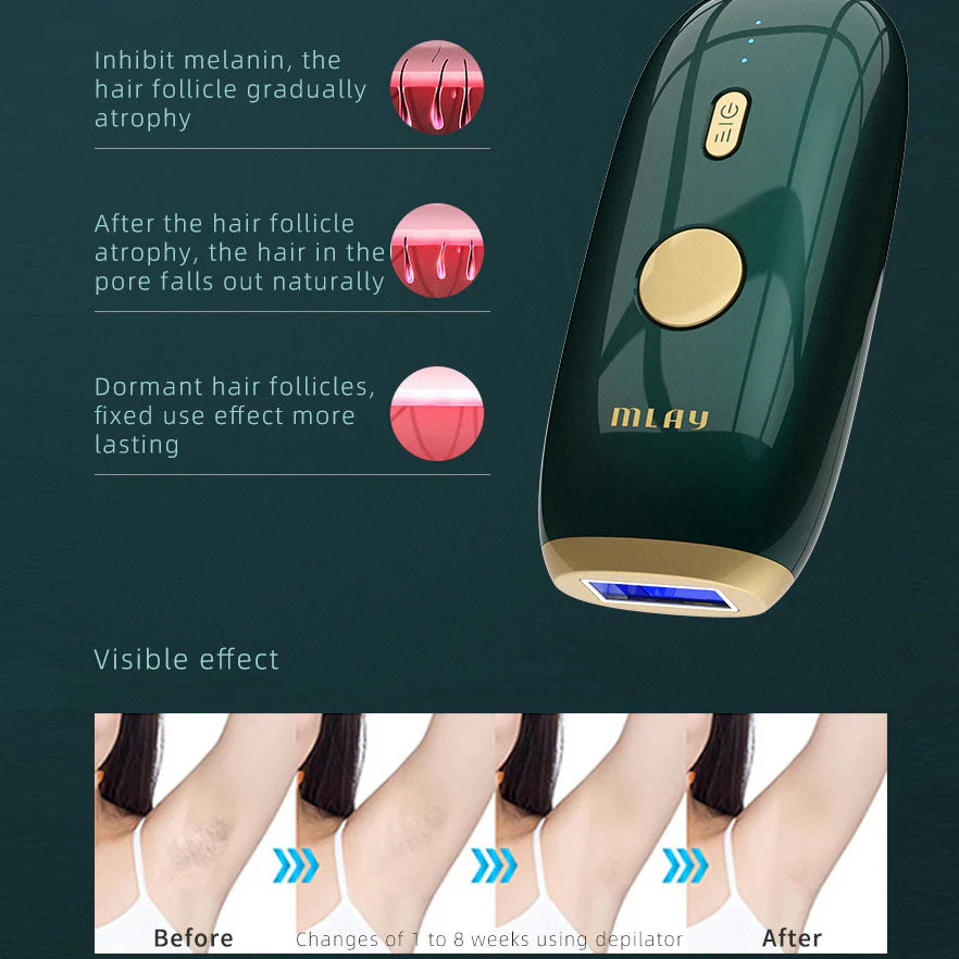 MLAY T11 Home Use IPL Laser Hair Removal Device For Women And Men